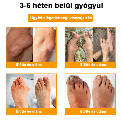 🔹𝑺𝒕𝒂𝒘𝑽𝒊𝒕𝒂𝒍® Botoxot és Méhmérget Tartalmazó Regeneráló Krém Ízületekre és Csontokra | MOT (Magyar Ortopéd Társaság) által tanúsított termék