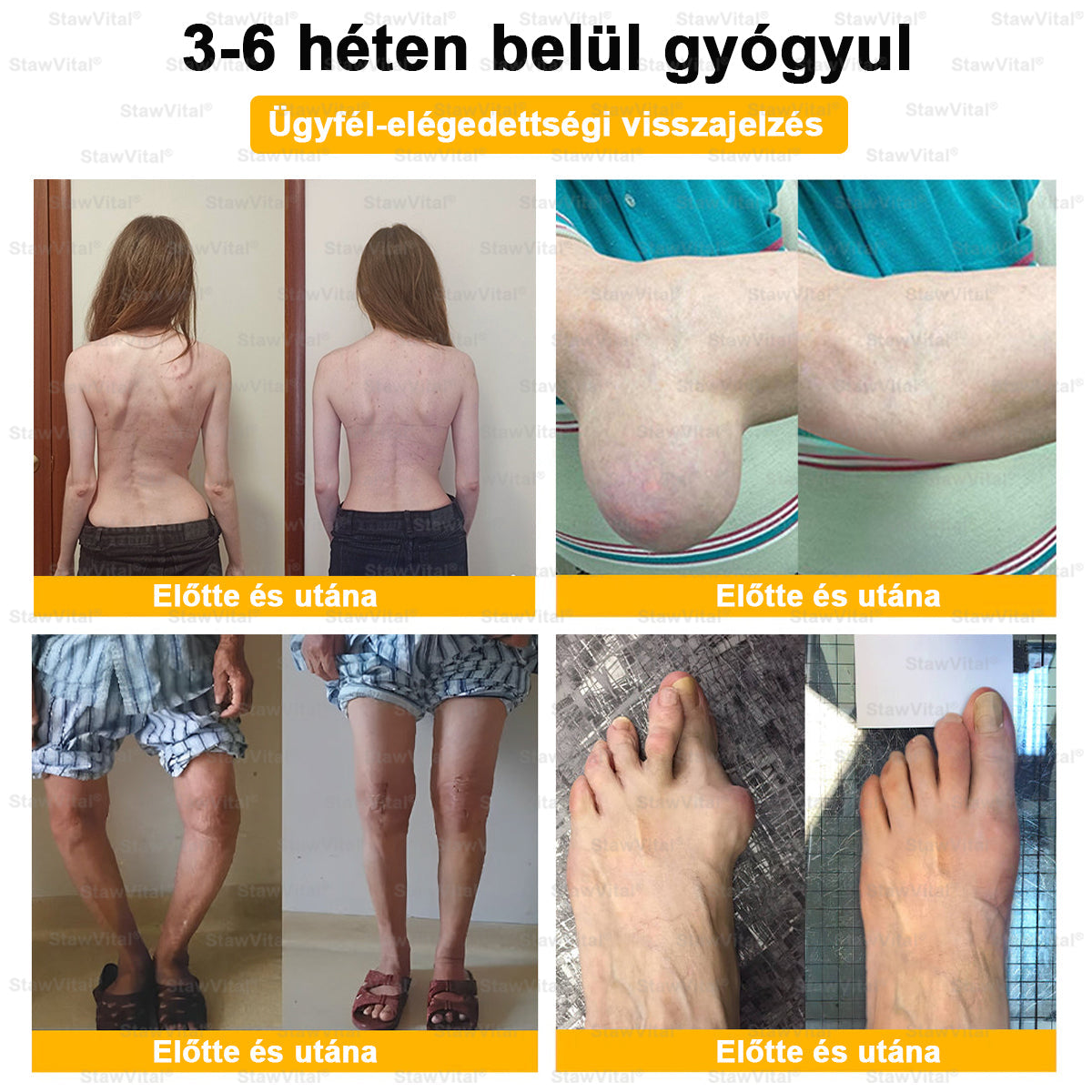 🟢𝑺𝒕𝒂𝒘𝑽𝒊𝒕𝒂𝒍® Botoxot és Méhmérget Tartalmazó Regeneráló Krém Ízületekre és Csontokra | MOT (Magyar Ortopéd Társaság) által tanúsított termék